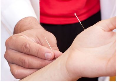 Acupuncture Therapy
