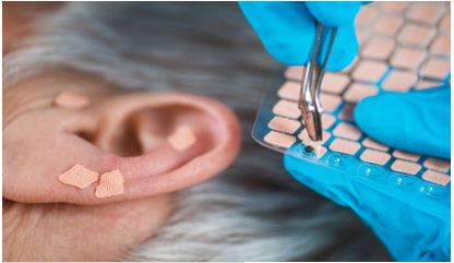 Auricular Therapy 1